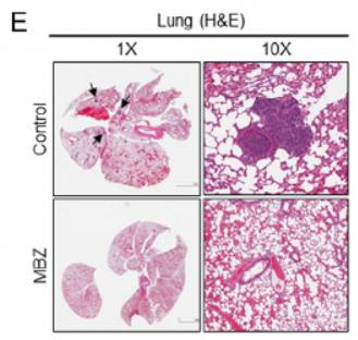 histological evaluation of pulmonary metastatic lesions